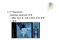 [한의학] Cushing‘s syndrome(쿠싱 증후군)-6