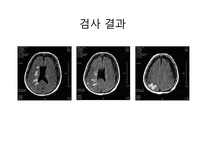 [한의학][침구사례] 불면을 호소하는 중풍환자-3