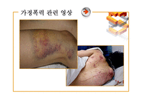 아내폭력에 관한 보고-6