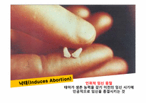 법률에 의한 낙태조사-3