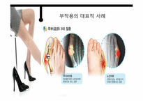 하이힐, 미니스커트, 스키니의 문제점과 예방법-18