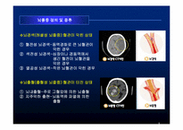 뇌졸중 환자와 가족을 위한 사회사업가의 역할-5