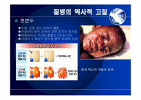 [세계화와 사회변동]질병, 범죄, 마약-10