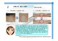 [약과건강] 보톡스 사용에 대하여-14