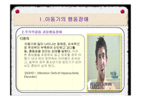 아동기의 발달장애-9