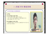 아동기의 발달장애-11