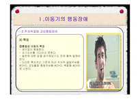 아동기의 발달장애-12
