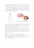 [생활과건강] 뇌졸중의 이해와 치료-2