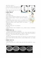 [생활과건강] 뇌졸중의 이해와 치료-11