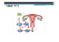 [과학사] 한국 불임치료의 역사-18