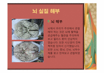 [간호실습] 중국해부학 실습과 북경문화 탐방-11