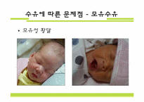 [영양학]수유종류에 따른 영아의 문제점과 성장발달과의 관계-6
