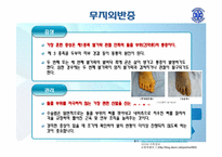 [질병의 이해와 관리] 일상생활속의 생활습관병-18