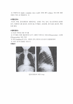 (아동)신생아 호흡곤란 능후군 문헌고찰-2