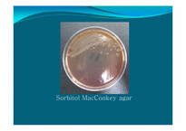 [미생물학] 식중독균 thrombocytopenia 세균학 실습-9
