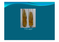 [미생물학] 식중독균 thrombocytopenia 세균학 실습-14