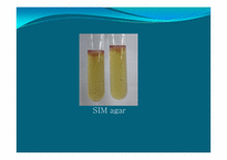 [미생물학] 식중독균 thrombocytopenia 세균학 실습-15