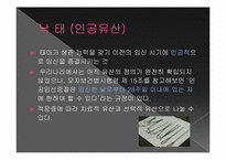 [간호윤리] 낙태(인공유산)에 관한 고찰-3