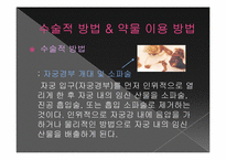 [간호윤리] 낙태(인공유산)에 관한 고찰-6