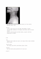 [의학과][응급의학과] 신경외과 사례(45세 남성환자)-3