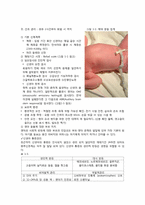 [간호학][산부인과] 신생아 관리-4