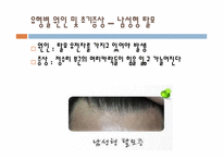 [화장품과학] 탈모의 이해 및 예방법-5