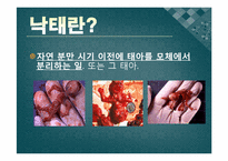 [보건행정학] 낙태의 찬반 논란, 허용범위 논란 및 낙태 문제 해결방안-3