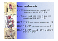[의학물리화학] 인공심장 기술-7