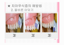 [간호학] 구강 보건 교육-6