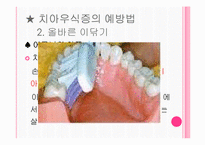 [간호학] 구강 보건 교육-7