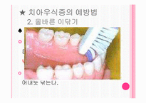 [간호학] 구강 보건 교육-8