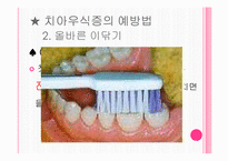 [간호학] 구강 보건 교육-9