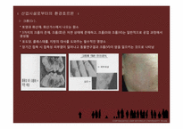 환경호르몬 레포트-13