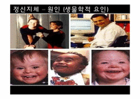 [이상심리] 정신지체 & 학습장애 특징, 치료 방법 및 사례 연구-17