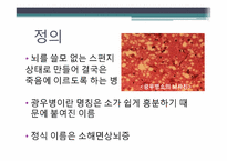 [인간질병과 건강한 삶] 광우병의 위험성 및 대처 방법-3