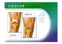 [체육과건강] 관절염(Arthritis)-5