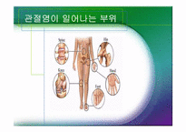 [체육과건강] 관절염(Arthritis)-6