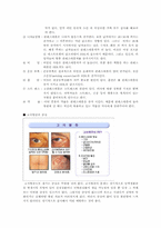 고지혈증(Hyperlipidemia)-3