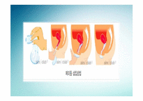 [성심리학] 피임의 역사, 조건, 종류-15
