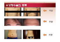 성형수술과 성형 신드롬-7