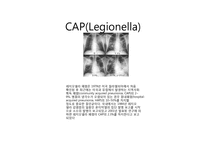 [감염학] CAP의 흉부방사선소견-4