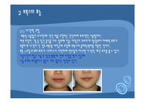보톡스의 허와 실-12