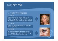 보톡스의 허와 실-19