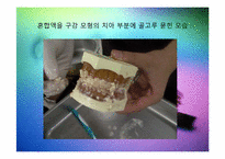 칫솔모양에 따른 치아세정능력 실험-13