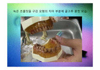 칫솔모양에 따른 치아세정능력 실험-15