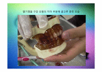 칫솔모양에 따른 치아세정능력 실험-17