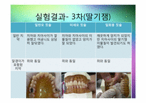 칫솔모양에 따른 치아세정능력 실험-20