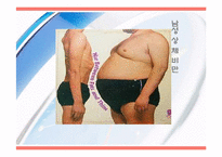 비만과 건강관리-7