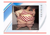 비만과 건강관리-8