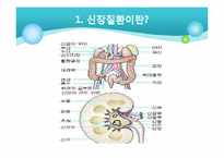 [의료사회복지] 만성신부전환자에 대한 사례개입-4